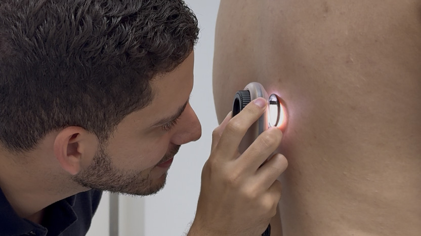 Revisión de lunares y lesiones de la piel