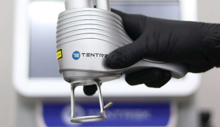 Láser-CO2-–-Regeneración-profunda-Tu-Piel